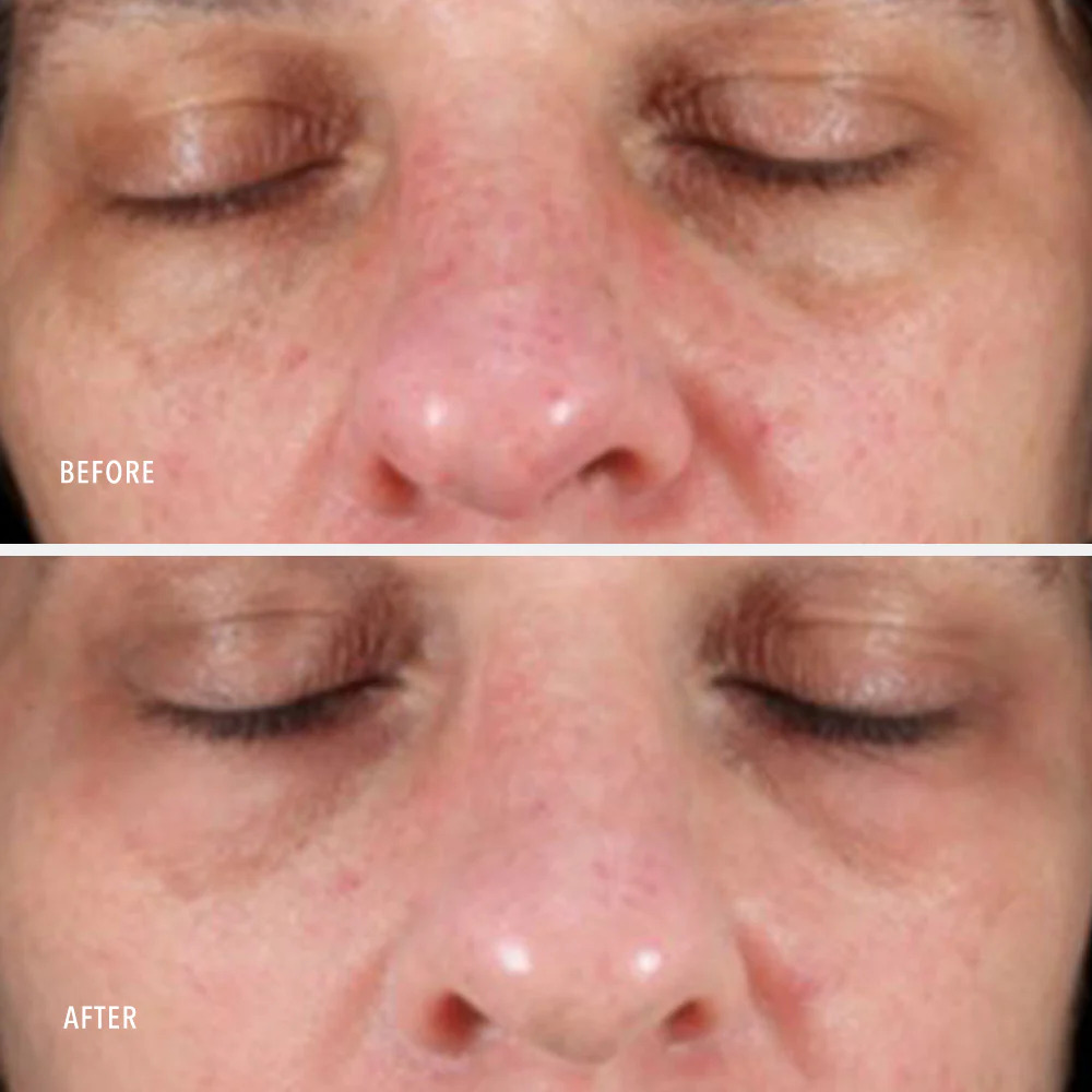 Зволожувальний ліфтинг-крем з ретинолом HydroPeptide Collagen ReActivate PM